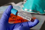 Coronavirus-COVID-19