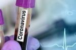 coronavirus-teste-1