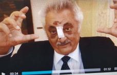 Nicolae Bacalbaşa, dus de urgenţă la spital! Are nasul rupt, un dinte spart şi e rănit la cap