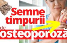 Iată ce trebuie să faci pentru a preveni osteoporoza!