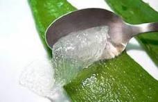 Aloe Vera vindecă arsurile şi iritaţiile pielii