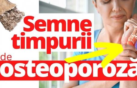 Iată ce trebuie să faci pentru a preveni osteoporoza!